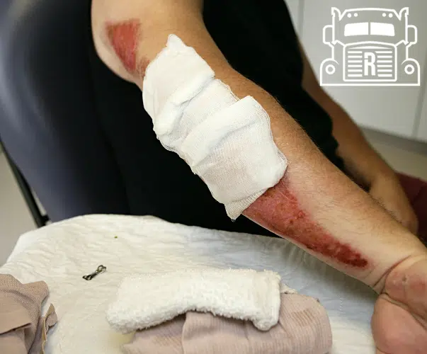 man with a bandage over road rash